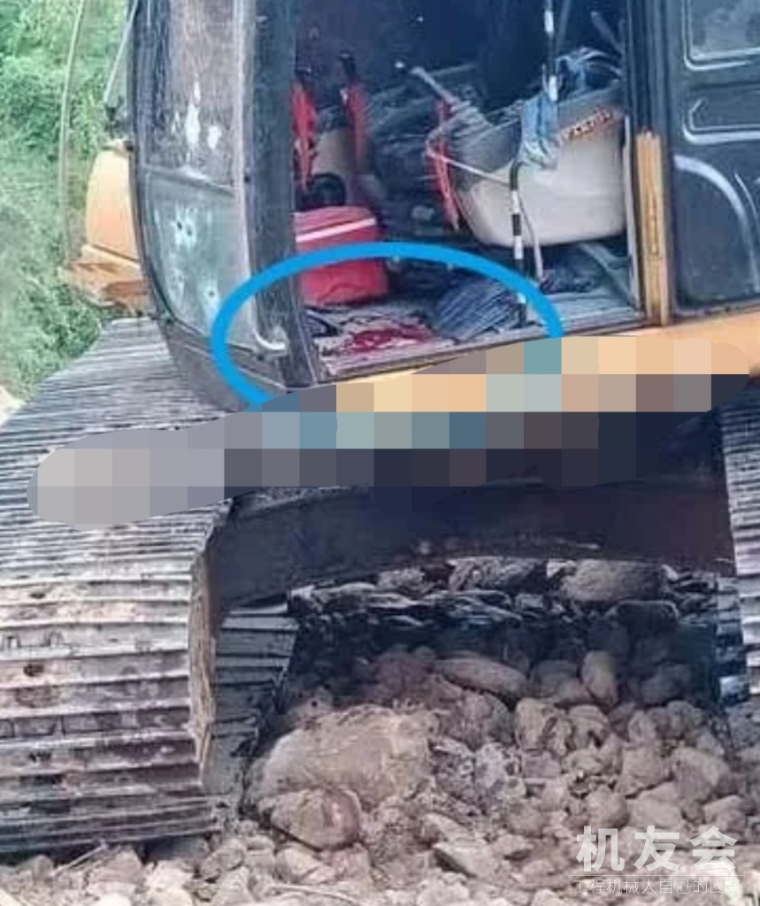 惨烈：挖机触发地雷，驾驶员被炸成重伤！[美挖]